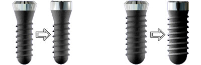 new narrower implants